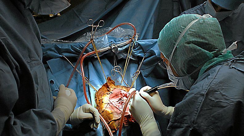 Taiwan réussit la 3e opération chirurgicale au monde sur le cerveau d’une sourde-muette éveillée