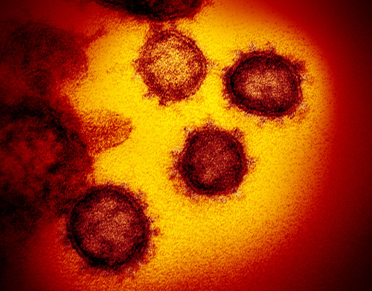Variants du virus du Covid-19 : deux souches pourraient être particulièrement contagieuses